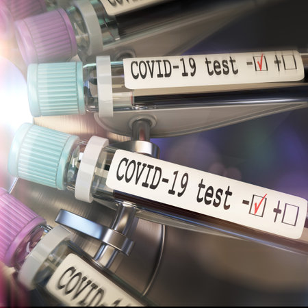 Negative COVID-19 test and laboratory sample of blood testing for diagnosis new Corona virus...