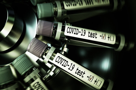 Tube of biological sample contaminated by Coronavirus with label Covid-19. Vials of blood in a...