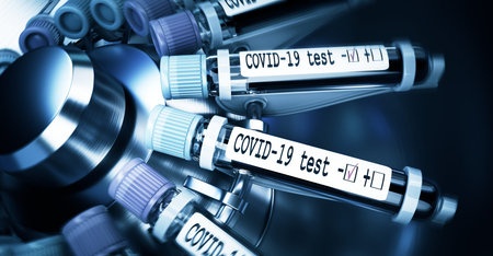 Coronaviruses research, conceptual illustration. Negative COVID-19 test and laboratory sample of...