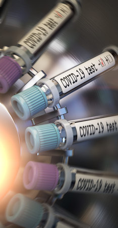 Negative COVID-19 test and laboratory sample of blood testing for diagnosis new Corona virus...