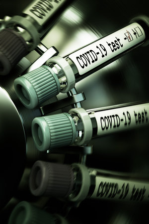 Tube of biological sample contaminated by Coronavirus with label Covid-19. Vials of blood in a...