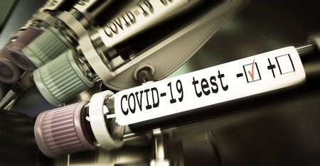 Vials of blood in a centrifuge. Negative COVID-19 test and laboratory sample of blood testing for diagnosis new Corona virus infection (novel corona virus disease 2019) . Pandemic infectious concept. 3D renderingの写真素材