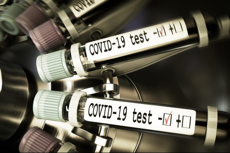Vials of blood in a centrifuge. Negative COVID-19 test and laboratory sample of blood testing for...