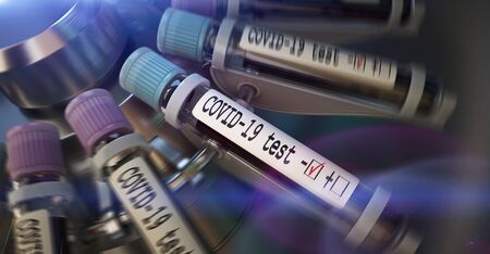 Negative COVID-19 test and laboratory sample of blood testing for diagnosis new Corona virus infection (novel corona virus disease 2019) from Wuhan. Pandemic infectious concept 3D renderingの写真素材