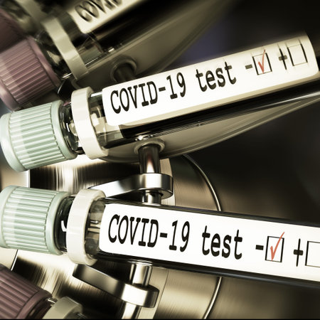 Vials of blood in a centrifuge. Negative COVID-19 test and laboratory sample of blood testing for...