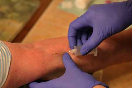 Blood sampling from a patient's vein. Hands of a nurse wearing gloves with a syringe