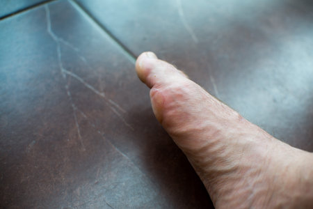 close up on Blister on foot of a male