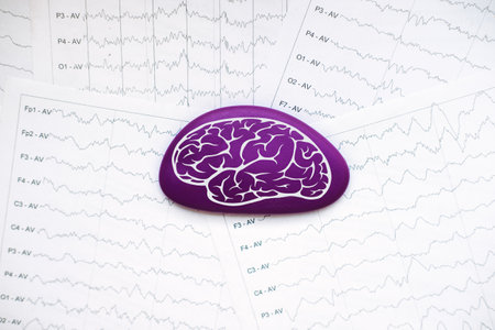 International Epilepsy Day, Epilepsy awareness. Purple brain drawing on brain wave on electroencephalogram EEG for epilepsyの写真素材