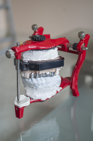Red adjustable dental articulator with metal tooth crowns
