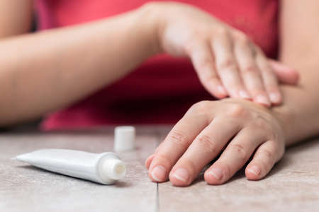 Woman is applying a moisturizer cream on her hands or anesthetic gel close up.