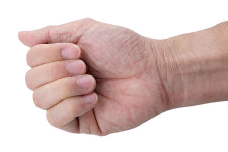 Senior man's fingers and nails that with dry skin, Cracked skin on cuticles, skin is torn and flaking off.の写真素材