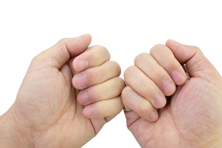 Close-up of fingers and nails with dry skin, torn and flaking off, cracked skin on cuticles, dry brittle nails. Broken fingernails inflammation. Chipped nails. Isolated on white background.の写真素材