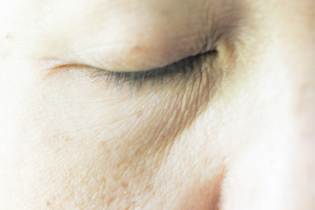 Asian woman eye with Bag under the eyeの写真素材