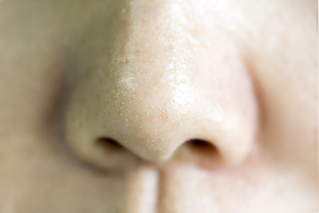 Close Up acne small pimple on nose. concept of beauty and health.の写真素材