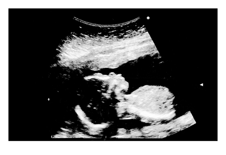 Ultrasound of baby in mother's womb.の写真素材