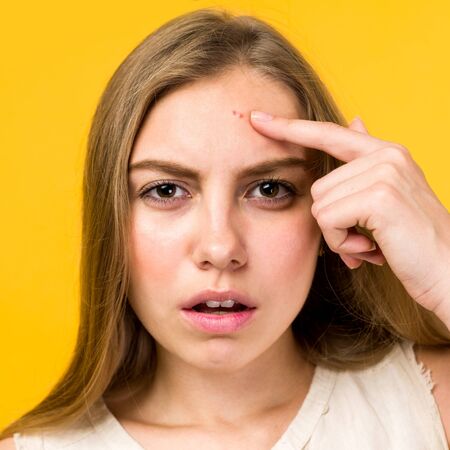 Portrait of sad teen gerl touching her face and looking for acne on yellow backgroundの写真素材