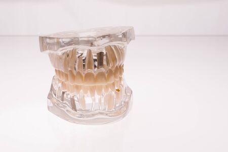 Transparent dentures jaw layout on a white background