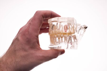 Dentist holding dentures jaw layout on a white background - imageの写真素材