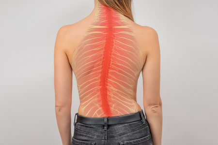 <p>Woman with scoliosis of the spine. Curved woman's back. Terrible pain in the spine</p>の写真素材