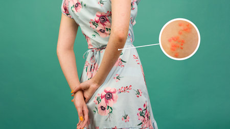 Macro detailed circles magnification psoriasis arm skin with different degrees wounds. Dry flaky...