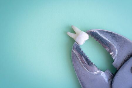 A torn tooth is clamped in large pliers on a green blue medical background. Copyspace top view.