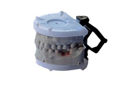 Dental model with upper and lower teeth mounted in plastic articulator for orthodontic and prosthodontic treatment planning. High quality photoの写真素材
