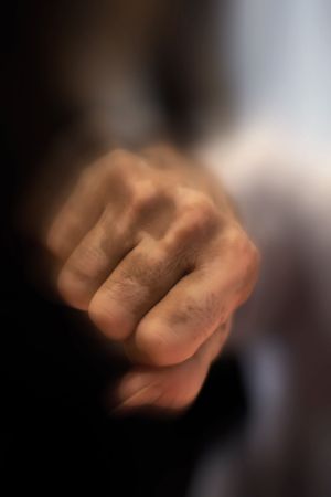 Man's fist affected by vitiligo illnessの写真素材