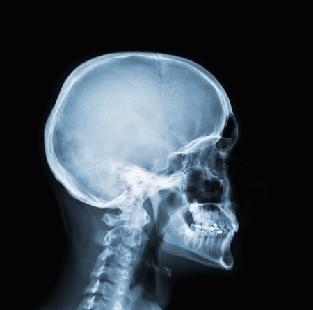 X-ray of headの写真素材