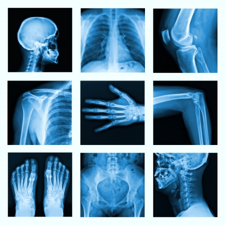 Collage of many X-rays in very good quality