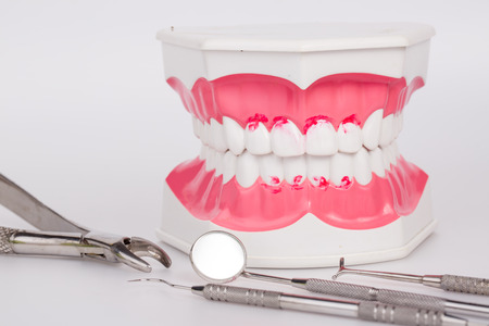 White teeth and dental instruments on white backgroundの写真素材