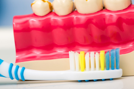 White teeth and dental instruments