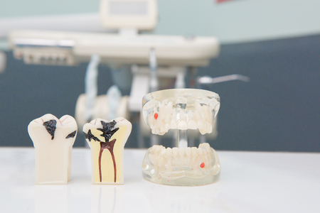 Dental Teeth Model and dental toolの写真素材