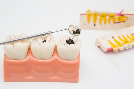 Dental Teeth Model and dental toolの写真素材