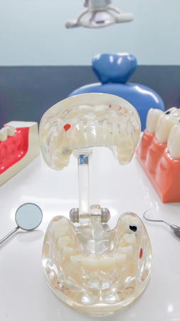 dental model,teeth model on white background.