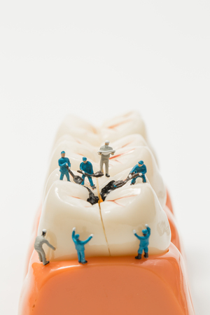 People to clean tooth model on white background,miniatureの写真素材