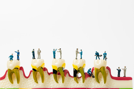 People to clean tooth model on white background,miniatureの写真素材