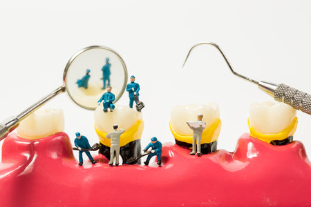 People to clean tooth model on white background,miniatureの写真素材