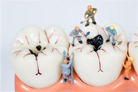 miniature people clean tooth model,medical conceptの写真素材