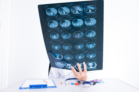 doctor woman looking ct scan film
