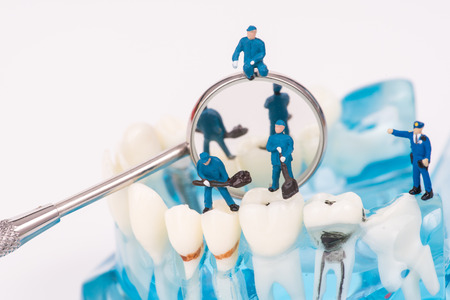 miniature people use dental tool clean tooth or dental model,medical conceptの写真素材