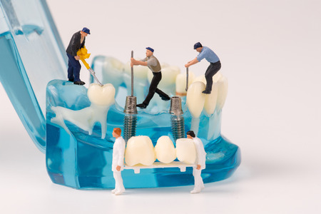 miniature people and dental model,dental care conceptの写真素材