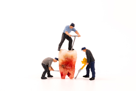 miniature figure people with dental modelの写真素材