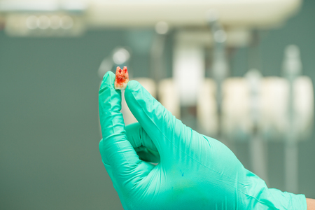 dentist hand holding show teeth after removal