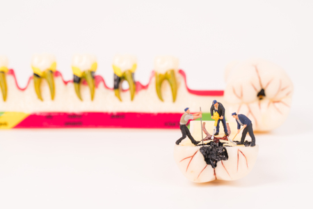 miniature people and dental model,dental care conceptの写真素材