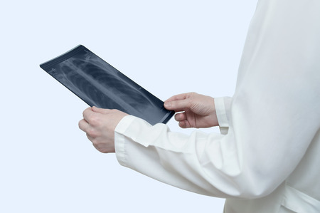 Doctor in white lab coat holds x-ray in white on white backgroundの写真素材
