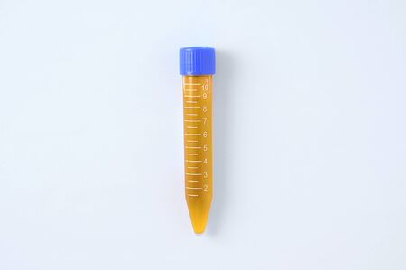 Laboratory plastic flask with a blue cap with urine tests on a white background.