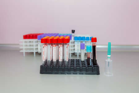 November 10, 2020 Chisinau Moldova Vacuum blood sampling system in a Vacuette container. Analyzes in the clinic. Illustrative editorialのeditorial素材