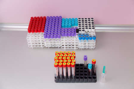 November 10, 2020 Chisinau Moldova Vacuum blood sampling system in a Vacuette container. Analyzes in...