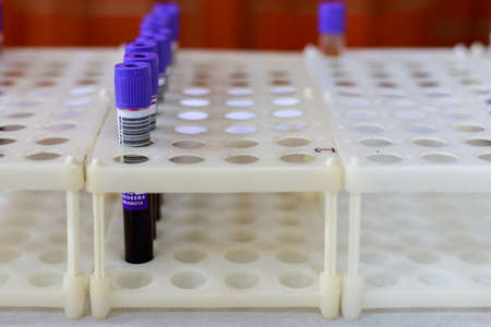 Medical test tubes for blood. Public event for blood donor day. Background with copy space for text...