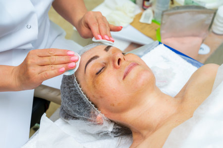 May 17, 2022 Balti Moldova. Beautician performs the procedure. Illustrative editorial. Backgroundのeditorial素材